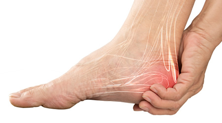 Heel Pain